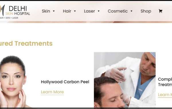 How costly is hair transplant?